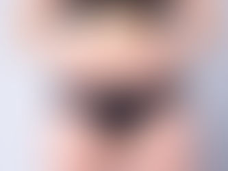 Tummy Tuck Abdominoplasty Surgery in ANTALYA TURKEY