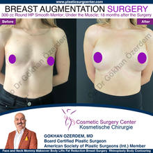 Breast Augmentation Before After
Breast Implants Turkey Antalya
