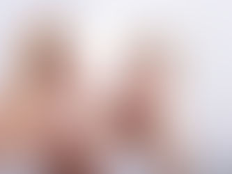 Facelift Surgery Rhytidectomy in TURKEY ANTALYA